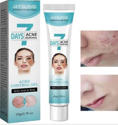 CREMA TRATAMIENTO ELIMINA ACNE - MASCARILLA FACIAL QUITA BARROS