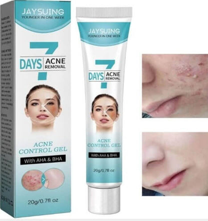CREMA TRATAMIENTO ELIMINA ACNE - MASCARILLA FACIAL QUITA BARROS