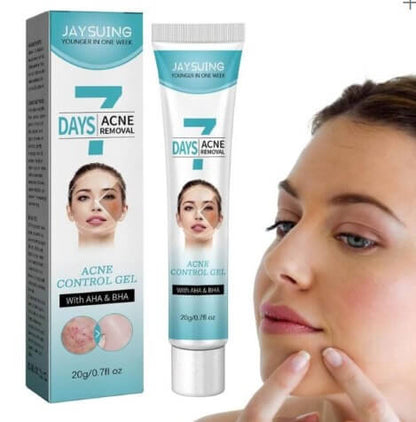 CREMA TRATAMIENTO ELIMINA ACNE - MASCARILLA FACIAL QUITA BARROS