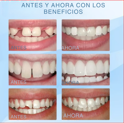 KIT REPARADOR MOLDEADOR PARA DIENTES