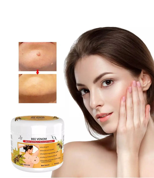 VENENO DE ABEJA - CREMA PARA EL TRATAMIENTO DE VERRUGAS, LUNARES, CICATRICES O IMPERFECCIONES